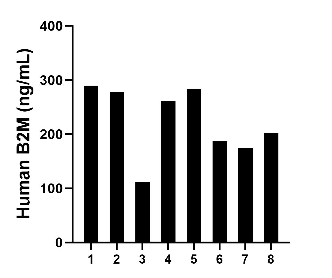 Serum of eight individual healthy human donors was measured. The B2M concentration of detected samples was determined to be 223.48 ng/mL with a range of 111.44-289.89 ng/mL.